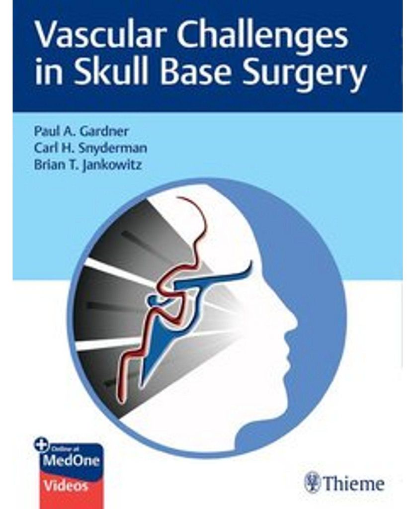 Vascular Challenges in Skull Base Surgery
