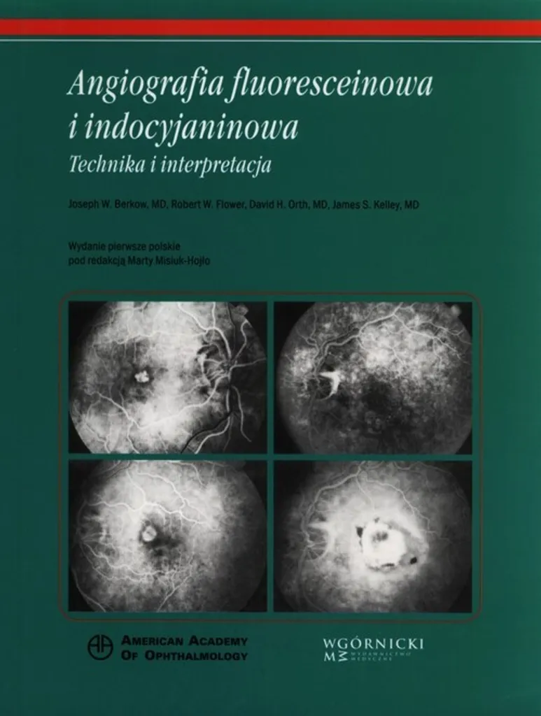 Angiographie à la fluorescéine et à l'indocyanine - Atlas d'Ophtalmologie