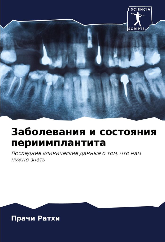Zabolewaniq i sostoqniq periimplantita