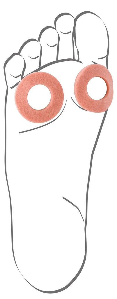 Berkemann Uni Hornhaut-Schutzring Sneaker, beige, Produktbild 