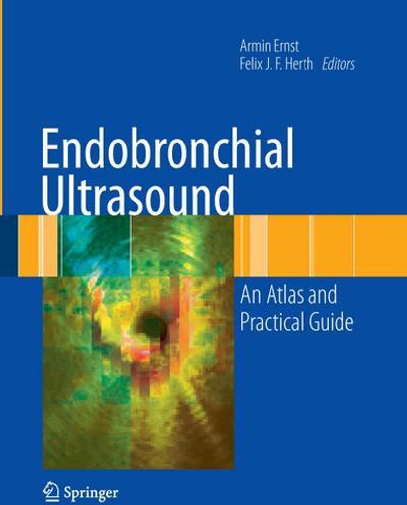 Endobronchial Ultrasound