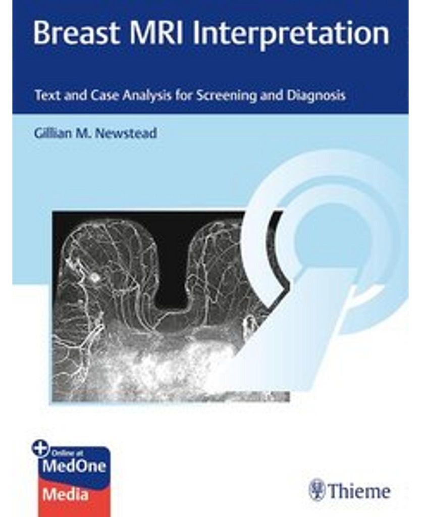 Breast MRI Interpretation