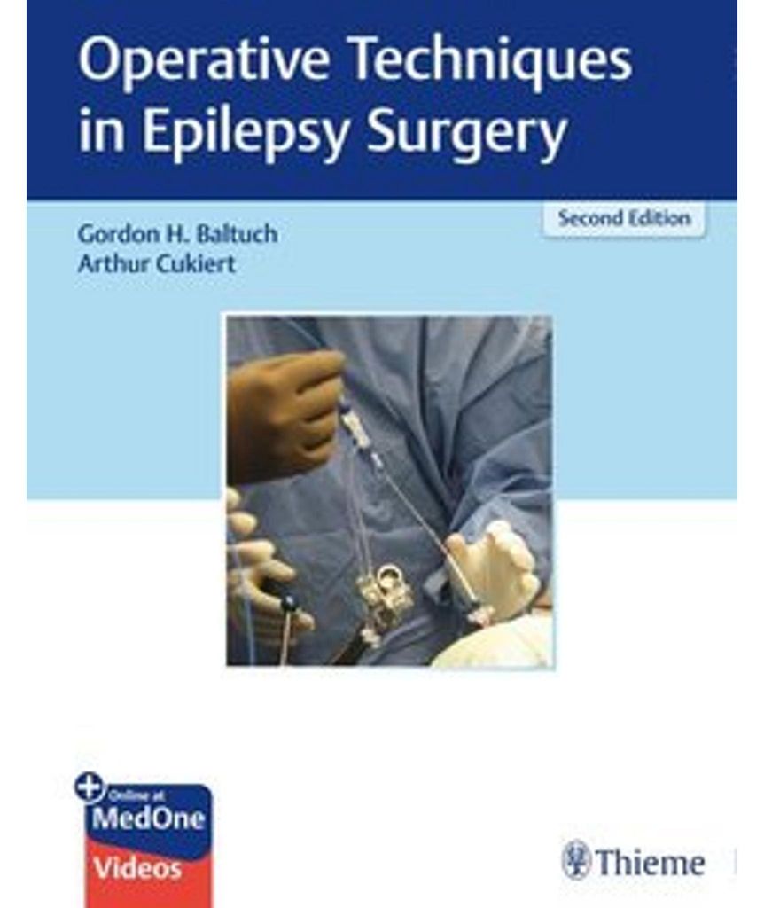 Operative Techniques in Epilepsy Surgery