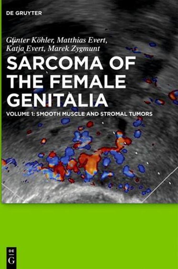 Smooth muscle and stromal tumors and prevention of inadequate surgery