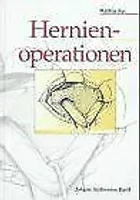 Hernienoperationen von Matthias Kux  Book