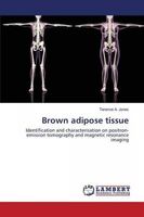 Brown adipose tissue