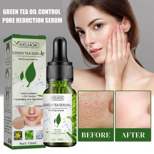 3 x 10 ml Grüntee-Öl zur Kontrolle des Porenschrumpfens des Gesichtsserums Whitening Entfernen Sie dunkle Flecken Verbessern Sie Akne Mitesser Trockene Hautpflege