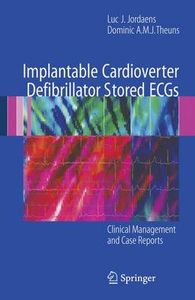 Implantable Cardioverter Defibrillator Stored ECGs : Clinical Management and Case Reports
