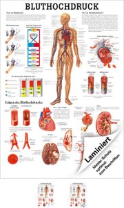 Bluthochdruck Poster Anatomie 70x50 cm medizinische Lehrmittel
