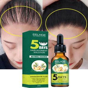5 Tage Ingwer Haarwachstum Serum, Anti-Haarausfall Haarserum Haarausfallbehandlung verhindern -30ml
