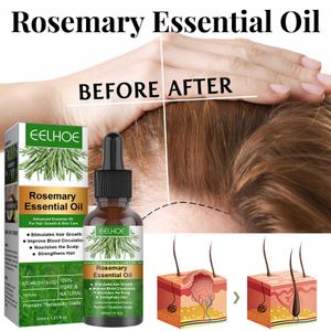 30ML Ätherisches Rosmarinöl, Rosmarinöl für Haarwuchs und Hautpflege, nährende Kopfhaut, stimuliert das Haarwachstum, verbessert die Durchblutung, beseitigt juckende und trockene Kopfhaut