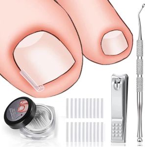 Das Kit zur Korrektur eingewachsener Zehennägel enthält 60 Stück Korrekturband + Heber für eingewachsene Zehennägel und Nagelknipser