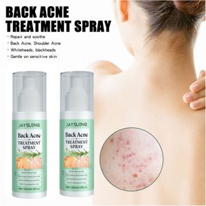 2 Stk Rücken Akne Behandlungsspray, Akneflecken Spray für Rücken und Brust aufhellen, sanft zur Haut (120ml*2 )