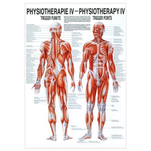 Triggerpunkte Mini-Poster Anatomie 34x24 cm medizinische Lehrmittel