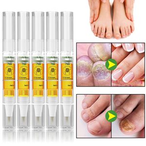 5x Anti Pilz Nail Behandlung Stift, nagelpilz stift, Pilz Nagel, Füße Zehen Hände Nagelpflege