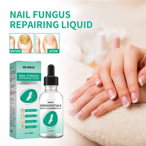 30ml Pilz Behandlung Pilz wirksame Finger Toe Nail Repair Flüssigkeit Füße Zehen Hände Nagelpflege cremes