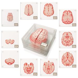 Untersetzer für anatomische Gehirnproben – Geschenke für Medizinstudenten, Geschenke für Gehirndekor, menschliche Anatomie