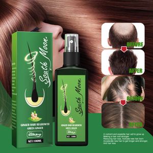 100ml Herbal Hair Growth Essence Spray,Hair Growth Serum Spray,Herbal Hair Growth Maximizer Spray,Hair Essential Oil Anti Hair Loss