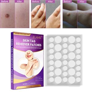 144Pcs Warzen Entferner Pflaster, Skin Tag Remover, Haut Tag Entferner Patch, Akne Patch Dots Hydrokolloid Pickel Zits Remover Patches