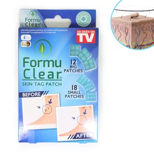 Formu Clear® Skin Tag Patch - 30 Stück – Warzenpflaster, Warzenentferner, schmerzfreie natürliche Behandlung, dermatologisch getestet