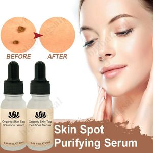 2 stk Organische Tag Entfernungslösungen Serum 20ml Schmerzlos Mole Skin Dark Spot Remover Serum Gesicht Pflege