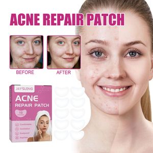 30pcs Akne Pickel Patches Skin Tag Remover Patch Akne Spot Behandlung Teebaumöl Hydrokolloid Master Bandagen Gesicht Körperpflege