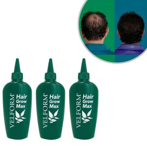 Velform® Hair Grow Max - 3er Set Haarwuchsmittel aus 22 Pflanzen, Haarwuchslotion mit natürlichen Inhaltsstoffen – Aus der TV Werbung