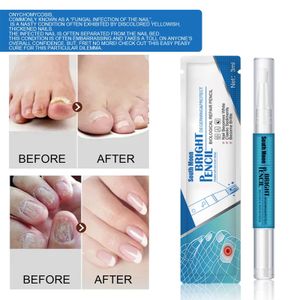 2x 3ml Nagelpflegestift, Nagelbehandlungsstift, Nail Care Pen Nährend zur Reparatur abgebrochener Nägel Für gesunde Füße und Hände