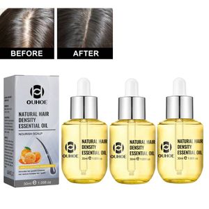3 Stück Ingwer Haarwachstumsserum ätherisches Öl stoppt Haarausfall, Haarwachstumsöl 30ml*3