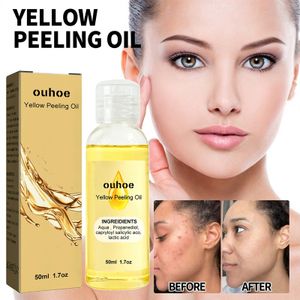 50ml Gelbes Peeling-Öl, Aufhellung von Flecken, Aufhellung der Haut Gelbes Peeling-Öl für Gesicht und Körper