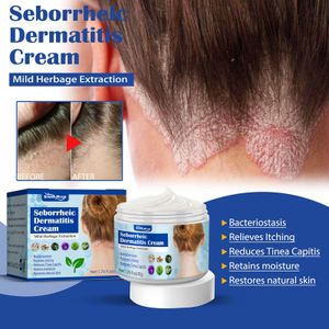2X50g Skin Akutpflege Creme,beruhigt juckende, trockene und zu Neurodermitis  Ekzemen neigende Haut,Seborrhoische Hautcreme,