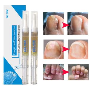 2 stk Nagelpilz Behandlung Stift, Pilz Nagel, Antipilz, Nagelpilzes Füße Zehen Hände Nagelpflege Cremes