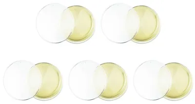 Produktbild von Solidchoice – 5er-Pack Schimmel-Testkit für den Hausgebrauch – Zur Erkennung von Schimmel im Haus