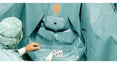 Produktbild von Hartmann Foliodrape Protect Urologie-Set V steril | Packung (4 Stück)