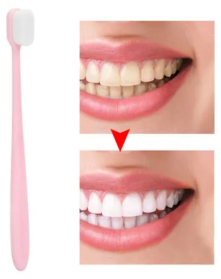 Image de Brosse à dents blanchissante à poils ultra-doux pour adultes et enfants (rose)