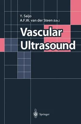 Zdjęcie produktu dla Vascular Ultrasound