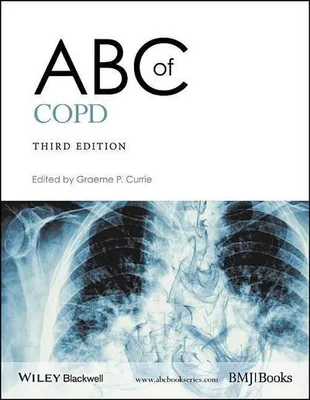 Obrázok produktu pre ABC of Copd