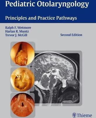 Produktbild von Pediatric Otolaryngology