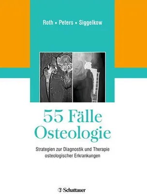 Produktbild von 55 Fälle Osteologie