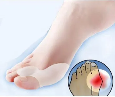 Produktbild von Jumada's - Zehenspreizer - Zehenspreizer - 4 Stück - Schmerzlinderung - (Hallux Valgus)
