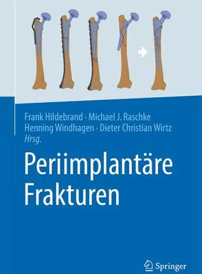 Produktbild von Periimplantäre Frakturen