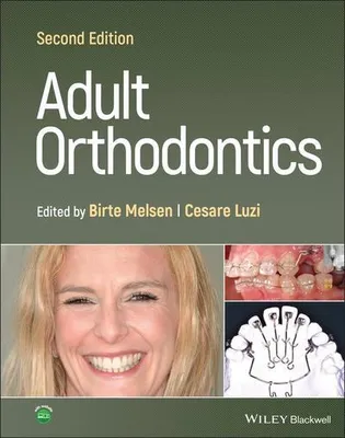 Obrázek produktu pro Adult Orthodontics