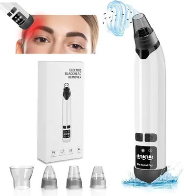 Produktbild von Mitesserentferner – Multifunktionaler Mitesserentferner mit Porensauger und Heizung, 4 Saugkraftarten mit LED-Anzeige