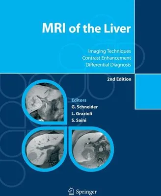 Obrázek produktu pro MRI of the Liver