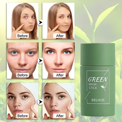 Produktbild von 2 Stück Grüntee-Stick-Maske, Ölkontrolle, Anti-Acne, Deep Cleanse