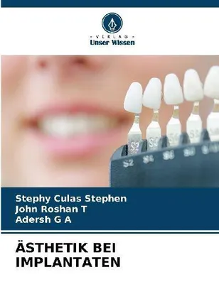 Produktbild von Ästhetik Bei Implantaten