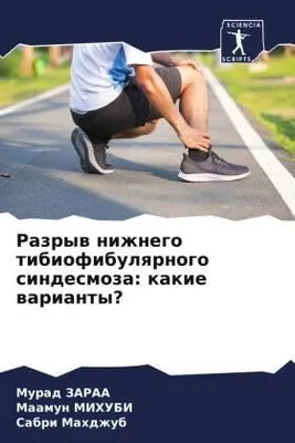 Produktbild von Razryw nizhnego tibiofibulqrnogo sindesmoza: kakie warianty?