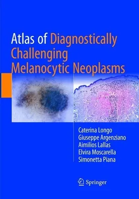 Produktbild von Atlas of Diagnostically Challenging Melanocytic Neoplasms