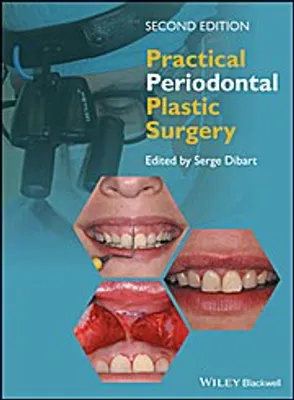 Zdjęcie produktu dla Practical Periodontal Plastic Surgery