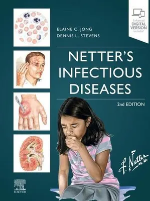 Produktbild von Netter's Infectious Diseases